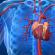 Chronické cor pulmonale: klinické příznaky a doporučení léčby 2 Medikamentózní léčba
